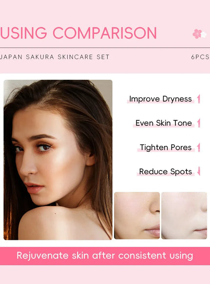 KissICON 1set KissIcon Sakura Skin Care Set - Complete Facial