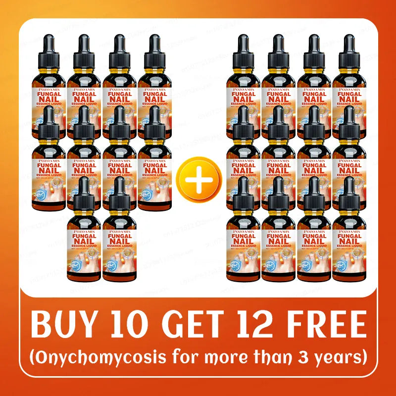 KissICON Buy 10 Get 12 Free KissIcon Nail Art Tool Oil - Fast Acting