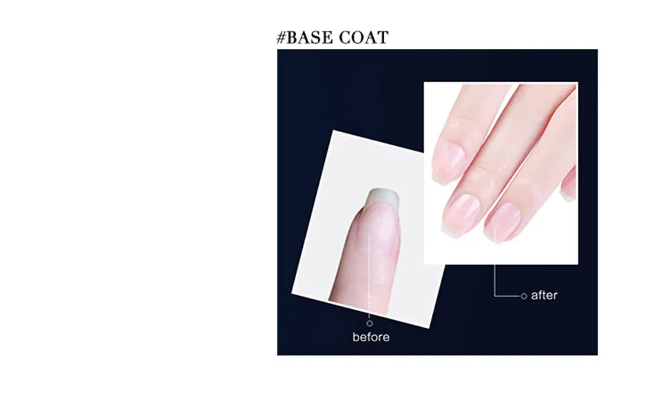 KissICON KissIcon Gel Polish Set Base Coat For Nails