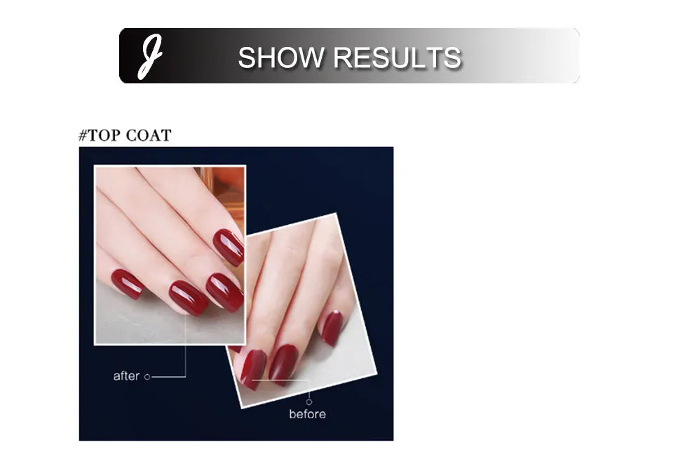 KissICON KissIcon Gel Polish Set Base Coat For Nails