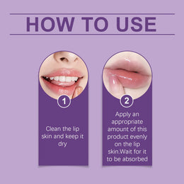 KissICON KissIcon Moisturizing Lip Balm - Hydrates Dry Lips