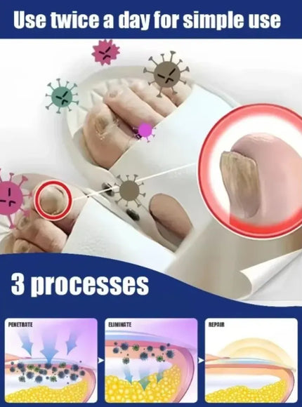 KissICON KissIcon Nail Art Manicure Tool - Plastic Dust