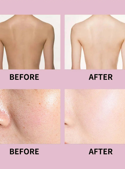 KissICON KissIcon Strawberry Shortcake Body Spray - Moisturizing