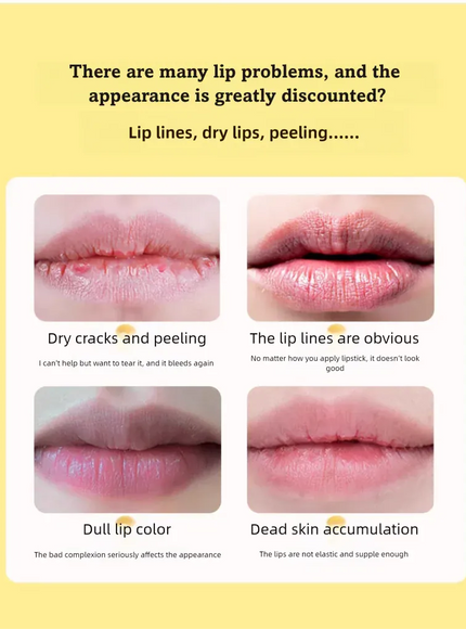 KissICON Lakerain Summer Moisturizing Lip Balm Daily Hydration