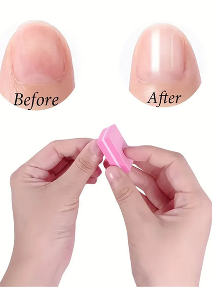 KissICON Pink 30 pcs KissIcon Nail Care Kit Mini Files Buffers -