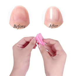 KissICON Pink 30 pcs KissIcon Nail Care Kit Mini Files Buffers -