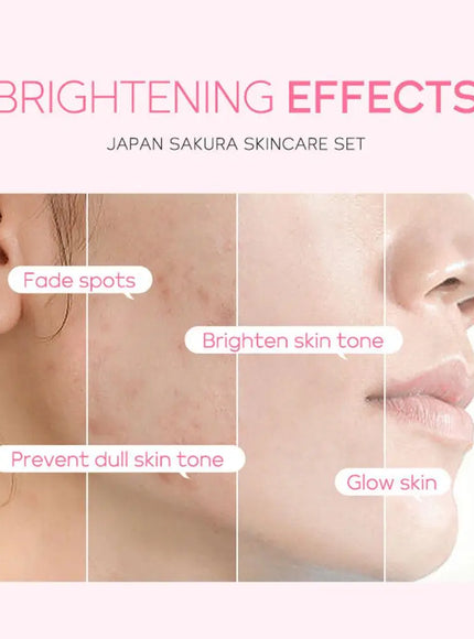 KissICON set KissIcon Sakura Skin Care Set - All In