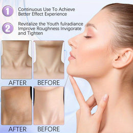 KissICON Variant1 KissIcon Neck Firming Cream - Tighten And Lift